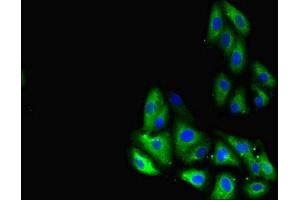Immunofluorescent analysis of HepG2 cells using ABIN7153873 at dilution of 1:100 and Alexa Fluor 488-congugated AffiniPure Goat Anti-Rabbit IgG(H+L) (GLP1R 抗体  (AA 24-145))