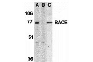 Western Blotting (WB) image for anti-Beta-secretase 1 (BACE1) (C-Term) antibody (ABIN1030276) (BACE1 抗体  (C-Term))