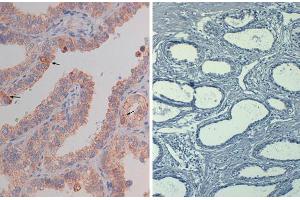 Immunohistochemistry (IHC) image for anti-V-Akt Murine Thymoma Viral Oncogene Homolog 1 (AKT1) (pSer473) antibody (Biotin) (ABIN1043752)
