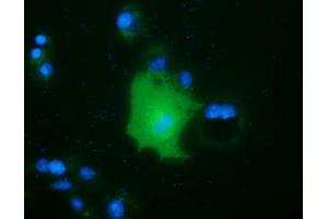 Anti-FAM84B mouse monoclonal antibody (ABIN2453035) immunofluorescent staining of COS7 cells transiently transfected by pCMV6-ENTRY FAM84B (RC207996). (FAM84B 抗体)