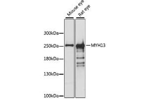 Western blot analysis of extracts of various cell lines, using MYH13 antibody. (MYH13 抗体)