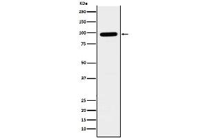 Western blot analysis of GLB1 expression in SH-SY5Y cell lysate. (Recombinant GLB1 抗体)