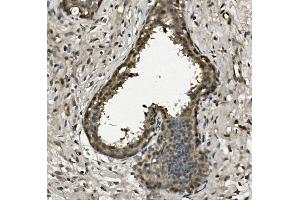 IHC analysis of RPA32/RPA2 using anti-RPA32/RPA2 antibody (ABIN7601380). (RPA2 抗体  (AA 34-254))