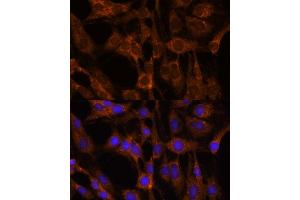 Immunofluorescence analysis of C6 cells using BRPF1 antibody (ABIN7265938) at dilution of 1:100. (BRPF1 抗体  (AA 1-200))