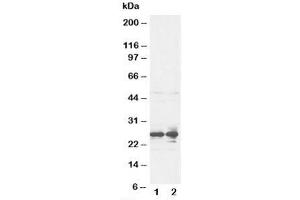 Western blot testing of FGF8 antibody and rat ovary tissue lysate (FGF8 抗体  (C-Term))