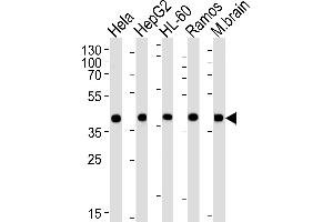 Western blot analysis of lysates from Hela, HepG2, HL-60, Ramos, mouse brain cell line (from left to right), using GOT2 Antibody (N-term) (ABIN652917 and ABIN2842590). (GOT2 抗体  (N-Term))