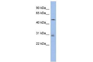 WB Suggested Anti-SMAP1 Antibody Titration: 0. (SMAP1 抗体  (Middle Region))