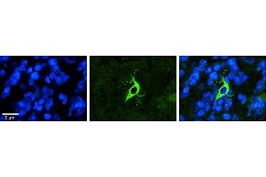 Rabbit Anti-TMX4 Antibody     Formalin Fixed Paraffin Embedded Tissue: Human Pineal Tissue  Observed Staining: Cytoplasmic in cell bodies and processes of pinealocytes  Primary Antibody Concentration: 1:100  Secondary Antibody: Donkey anti-Rabbit-Cy3  Secondary Antibody Concentration: 1:200  Magnification: 20X  Exposure Time: 0. (TMX4 抗体  (C-Term))