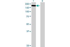 Western Blotting (WB) image for MAP3K5 293T Cell Transient Overexpression Lysate(Denatured) (ABIN1332589)
