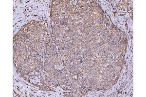IHC analysis of CLASP1 using anti-CLASP1 antibody (ABIN7599144). (CLASP1 抗体  (AA 1-243))