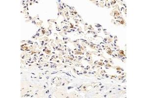 Immunohistochemistry of paraffin embedded rat lung using HSP70B (ABIN7074173) at dilution of 1: 1000 (400x lens) (HSPA6 抗体)