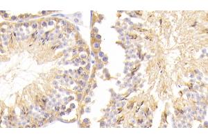Immunohistochemistry (IHC) image for anti-Ubiquitin Carboxyl-terminal Esterase L1 (Ubiquitin Thiolesterase) (UCHL1) (AA 2-223) antibody (ABIN7440260)
