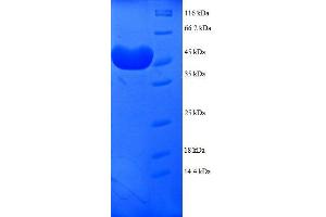 SDS-PAGE (SDS) image for Proteasome Subunit alpha  7 (PSMA7) (AA 5-232), (partial) protein (GST tag) (ABIN7479196)