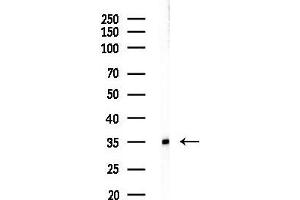 anti-Chromosome 1 Open Reading Frame 35 (C1orf35) (C-Term) antibody