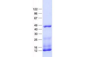 Validation with Western Blot (alpha KGDHC Protein (His tag))