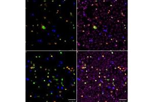 Immunostaining (ISt) image for anti-SARS-CoV-2 Spike S1 (RBD) antibody (ABIN6952546)