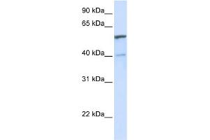 WB Suggested Anti-UGT1A6 Antibody Titration:  0. (UGT1A6 抗体  (C-Term))