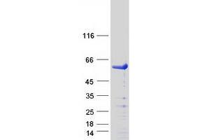 Western Blotting (WB) image for SMAD, Mothers Against DPP Homolog 3 (SMAD3) (Transcript Variant 1) (Active) protein (Myc-DYKDDDDK Tag) (ABIN2732221)