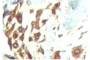 IHC testing of FFPE human breast tissue with ATF6 antibody at 5ug/ml. (ATF6 抗体  (N-Term))