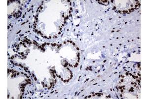 Image no. 5 for anti-Zinc Finger and SCAN Domain Containing 18 (ZSCAN18) antibody (ABIN1501861)