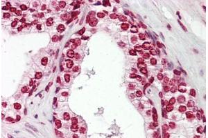 Anti-MKX antibody IHC staining of human prostate. (MKX 抗体  (AA 191-240))