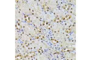 Immunohistochemistry (IHC) image for anti-Ribosomal Protein S27a (RPS27A) (AA 1-156) antibody (ABIN7270022)