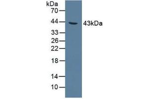 Detection of AGXT in Rat Liver Tissue using Polyclonal Antibody to Alanine Glyoxylate Aminotransferase (AGXT) (AGXT 抗体  (AA 182-371))