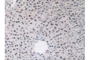 IHC-P analysis of Mouse Liver Tissue, with DAB staining. (TALDO1 抗体  (AA 35-285))