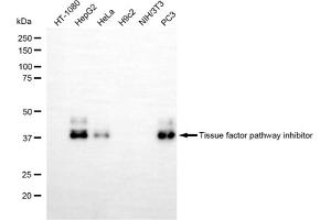 Western blotting analysis using tissue factor pathway inhibitor antibody (ABIN7800559). (Recombinant TFPI 抗体)
