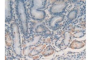Detection of DDIT3 in Human Stomach Tissue using Polyclonal Antibody to DNA Damage Inducible Transcript 3 (DDIT3) (DDIT3 抗体  (AA 1-169))