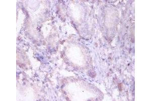 Immunohistochemistry (IHC) image for anti-Hydroxyacyl-CoA Dehydrogenase/3-Ketoacyl-CoA Thiolase/enoyl-CoA Hydratase (Trifunctional Protein), beta Subunit (HADHB) (AA 35-283) antibody (ABIN7173377)
