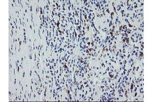 Image no. 2 for anti-Coagulation Factor XIII, A1 Polypeptide (F13A1) antibody (ABIN1498146) (F13A1 抗体)