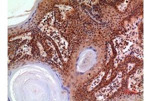 Immunohistochemistry (IHC) analysis of paraffin-embedded Human Skin, antibody was diluted at 1:100. (alpha 2 Macroglobulin 抗体  (Internal Region))