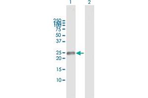 Western Blot analysis of TNFRSF18 expression in transfected 293T cell line by TNFRSF18 MaxPab polyclonal antibody. (TNFRSF18 抗体  (AA 1-241))