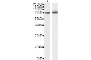 (ABIN185551) (2 μg/mL) staining of HEK293 (A),and A431 (B) nuclear cell lysate (35 μg protein in RIPA buffer). (OGFR 抗体  (C-Term))