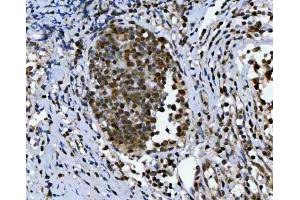 IHC analysis of TRIR using anti-TRIR antibody (ABIN7603244). (Uncharacterized Protein C19orf43 (TRIR) (N-Term) 抗体)