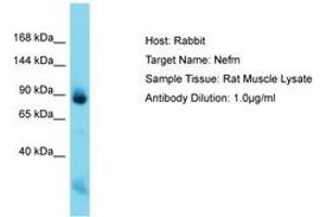 Image no. 1 for anti-Neurofilament Triplet M Protein (NEFM) (C-Term) antibody (ABIN6750526) (NEFM 抗体  (C-Term))