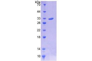 SDS-PAGE (SDS) image for Chromosome 10 Open Reading Frame 2 (C10ORF2) (AA 384-635) protein (His tag) (ABIN4989489)