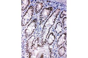 Anti-SHC antibody, IHC(F) IHC(F): Rat Intestine Tissue (SHC1 抗体  (C-Term))