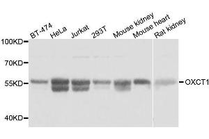 Western blot analysis of extracts of various cell lines, using OXCT1 antibody. (OXCT1 抗体  (AA 261-520))