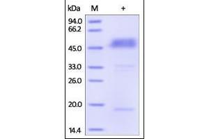 Human BTLA (31-134), Fc Tag on SDS-PAGE under reducing (R) condition. (BTLA Protein (AA 31-134) (Fc Tag))