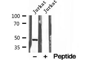 Western blot analysis of extracts of Jurkat cells, using Annexin VII antibody. (Annexin VII 抗体  (N-Term))