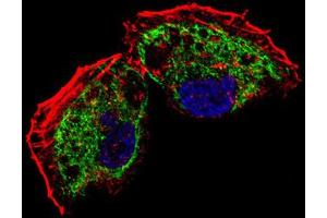 Immunofluorescence (IF) image for anti-Transcription Factor A, Mitochondrial (TFAM) antibody (ABIN5015230) (TFAM 抗体)