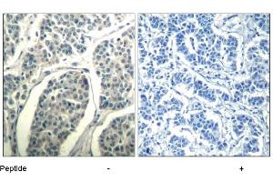 Image no. 1 for anti-Abelson Murine Leukemia Viral Oncogene Homolog 1/2 (ABL1/ABL2) (Tyr393), (Tyr429) antibody (ABIN319407)