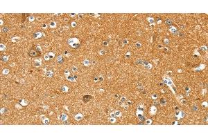 Immunohistochemistry of paraffin-embedded Human brain using PYGL Polyclonal Antibody at dilution of 1:35 (PYGL 抗体)