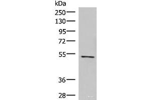 Western blot analysis of Jurkat cell lysate using POLD2 Polyclonal Antibody at dilution of 1:800 (POLD2 抗体)