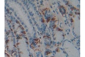 Detection of PACAP in Human Stomach Tissue using Polyclonal Antibody to Pituitary Adenylate Cyclase Activating Peptide (PACAP)