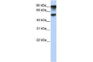 WB Suggested Anti-TBC1D10B Antibody Titration: 0. (TBC1D10B 抗体  (C-Term))