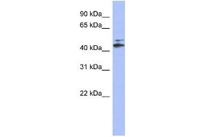 WB Suggested Anti-CYP20A1 Antibody Titration: 0. (CYP20A1 抗体  (N-Term))