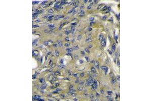 Immunohistochemistry (IHC) image for anti-C-Fos Induced Growth Factor (Vascular Endothelial Growth Factor D) (Figf) antibody (ABIN3002601) (VEGFD 抗体)